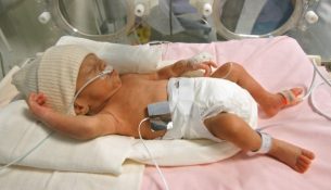 premature baby